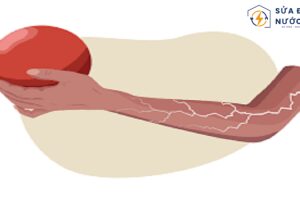 Hiện tượng người bị nhiễm điện: Nguyên nhân, hậu quả và cách phòng tránh